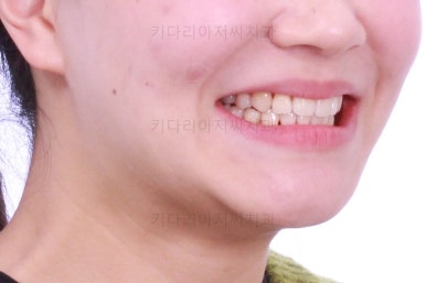 부산교정전문의