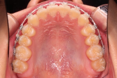 부산교정전문의