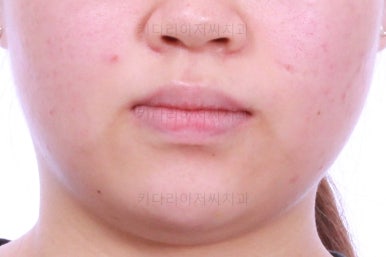부산치아교정치과