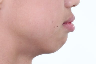 부산치아교정전문의