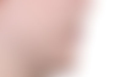 부산개방교합