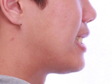 부산교정치과추천