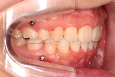 부산무턱교정치과