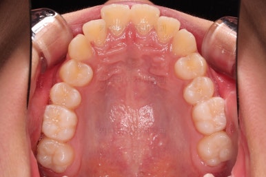 부산치아교정치과