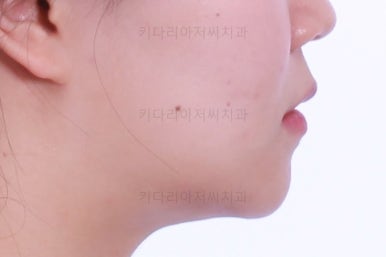 부산교정전문의