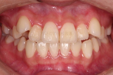 연산동교정치과