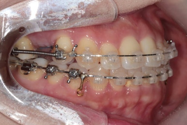 부산연산동치과