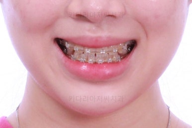 부산치과