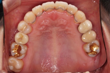 부산연산동치과