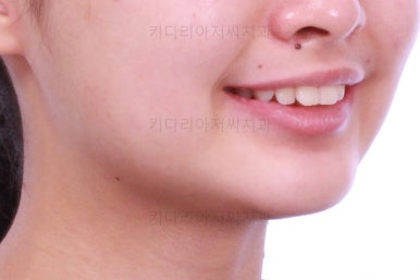 부산치아교정치과