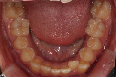 부산교정전문의