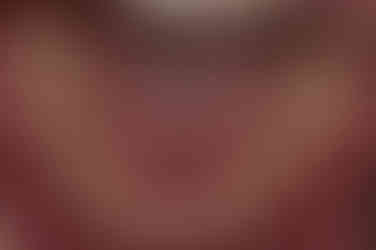 부산매복치아교정