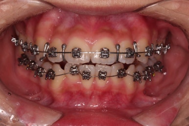 부산치아교정치과