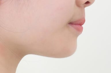 연산동교정치과