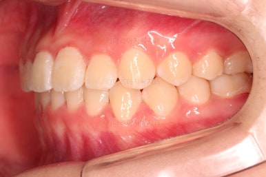 부산청소년교정치과