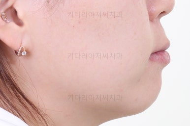 부산연산동치과