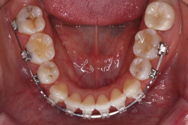 부산연산동교정치과