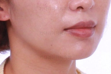 부산연산동교정치과