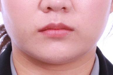 부산치아교정치과
