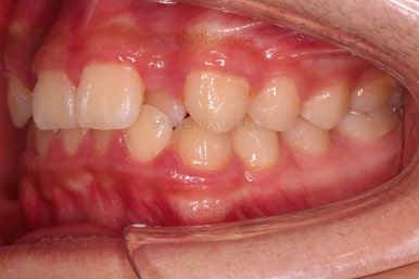 부산청소년교정