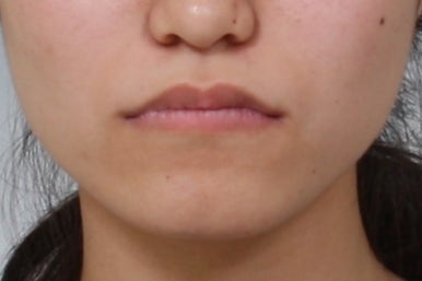 부산교정전문의