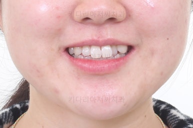 부산인비절라인