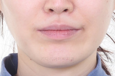 부산교정치과