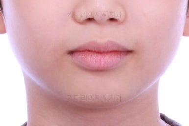 부산어린이교정