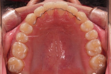 부산연산동치아교정