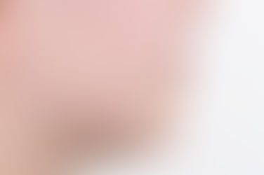 부산덧니교정