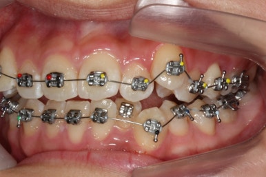 부산교정전문의