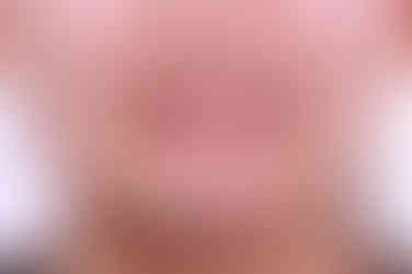 부산어린이치아교정