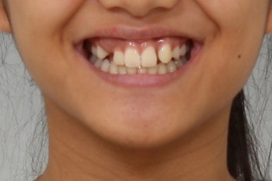 부산연산동청소년교정