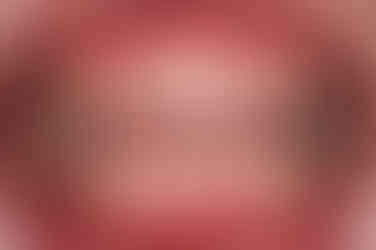 부산부분치아교정