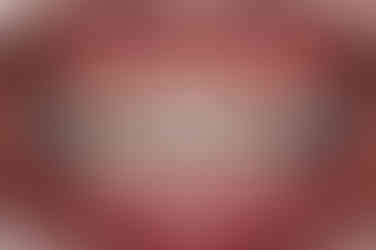 부산치아교정잘하는곳