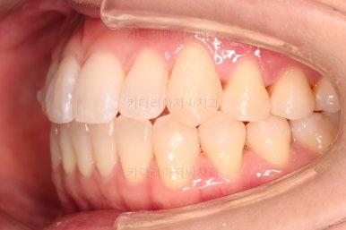 부산인비절라인