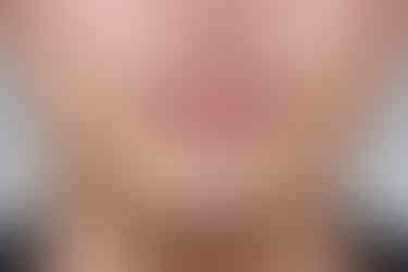 부산주걱턱교정