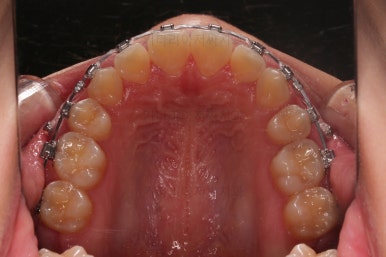 사직동교정치과