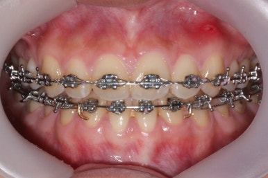 부산교정전문의
