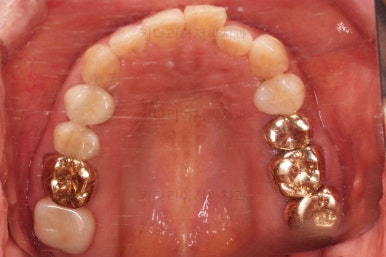 연산동부분교정