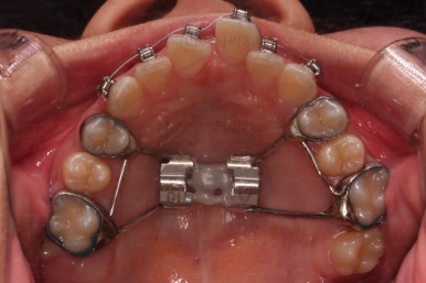 부산청소년교정치과