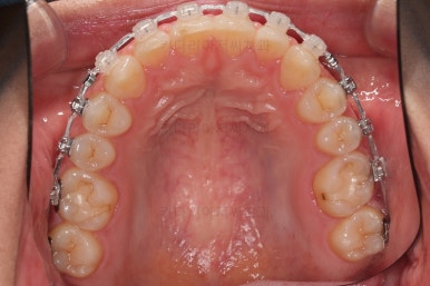 부산교정치과추천
