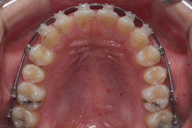 부산치아교정치과