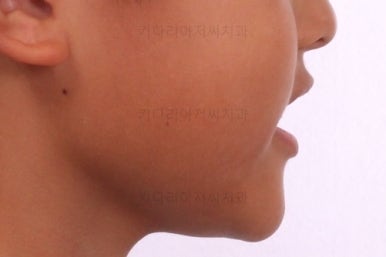 부산어린이교정
