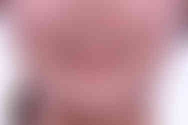 부산치아교정비용