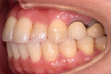 부산연산동치과