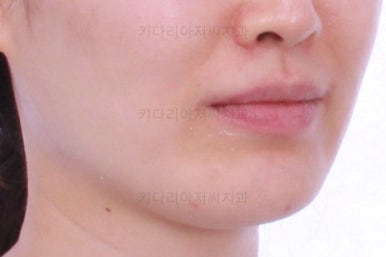 부산교정치과