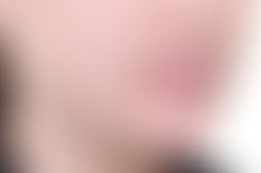 부산개방교합