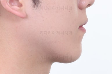 부산치아교정