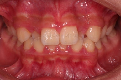 부산청소년교정